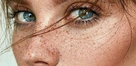 DERMOPIGMENTATION DU VISAGE
Les Freckels sont des tâches de rousseur semi-permanentes et très naturelles. La technique vise à rehausser des tâches naturellement présentes sur ta carnation, ou d’en créer pour donner à ton teint une mine ensoleillée, effet sortie de vacances. Mais aussi création d’un grain de beauté ou grain de coeur semi-permanent
